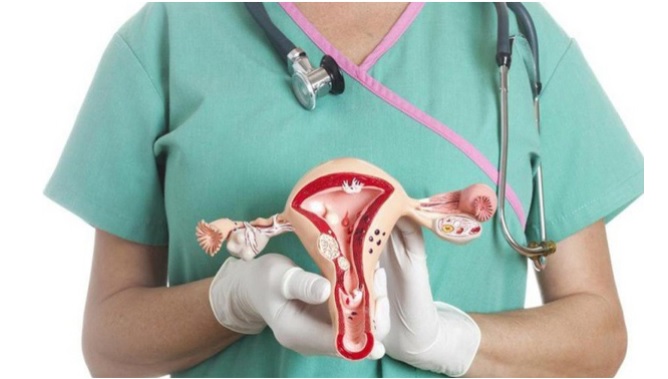 Biểu hiện ung thư buồng trứng giai đoạn đầu như thế nào?